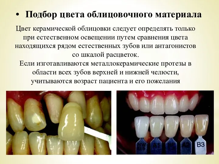 Цвет керамической облицовки следует определять только при естественном освещении путем