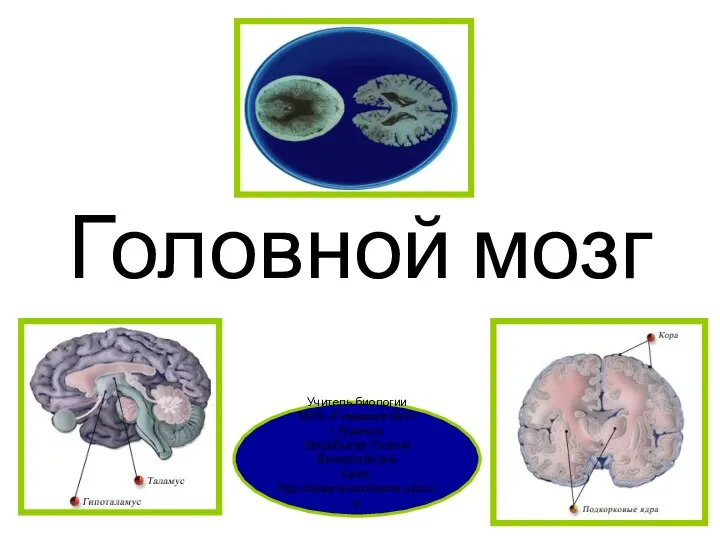 Головной мозг Учитель биологии МОУ «Гимназия №3» г. Брянска Воробьева Оксана Вячеславовна Сайт: http://oksanavorobyova.ucoz.ru