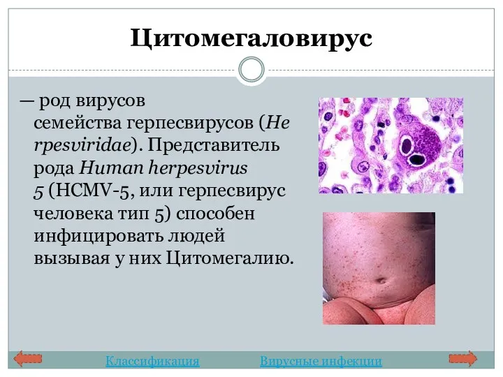 Цитомегаловирус — род вирусов семейства герпесвирусов (Herpesviridae). Представитель рода Human