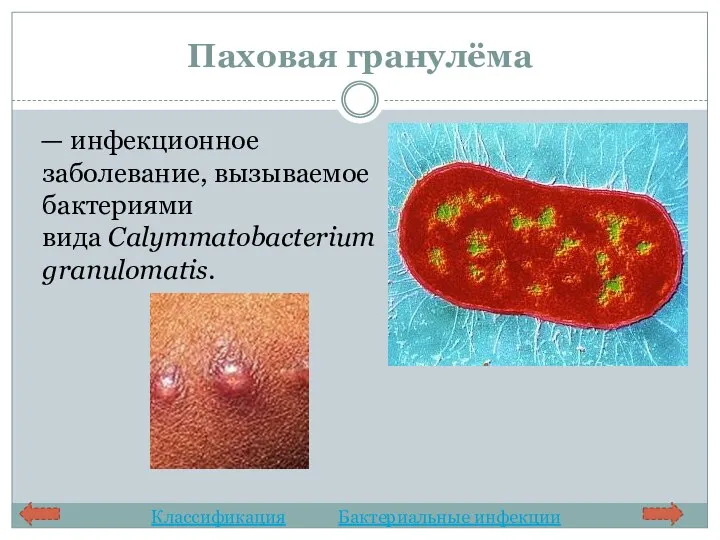 Паховая гранулёма — инфекционное заболевание, вызываемое бактериями вида Calymmatobacterium granulomatis. Классификация Бактериальные инфекции