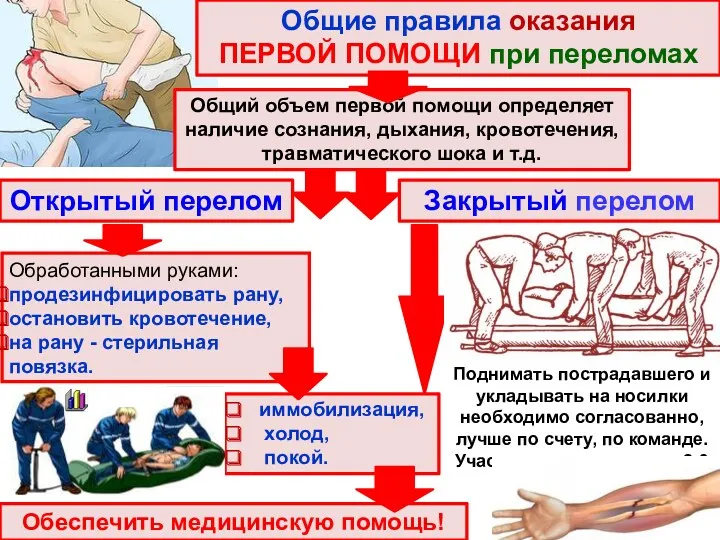 Открытый перелом Обработанными руками: продезинфицировать рану, остановить кровотечение, на рану