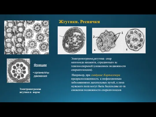 Жгутики. Реснички Электронограмма жгутика в норме Электронограмма жгутика спер­матозоида пациента,