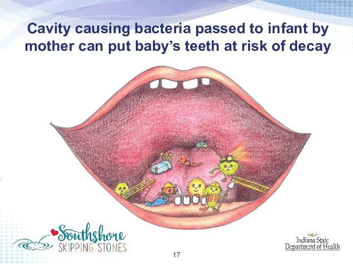 Cavity causing bacteria passed to infant by mother can put baby’s teeth at risk of decay