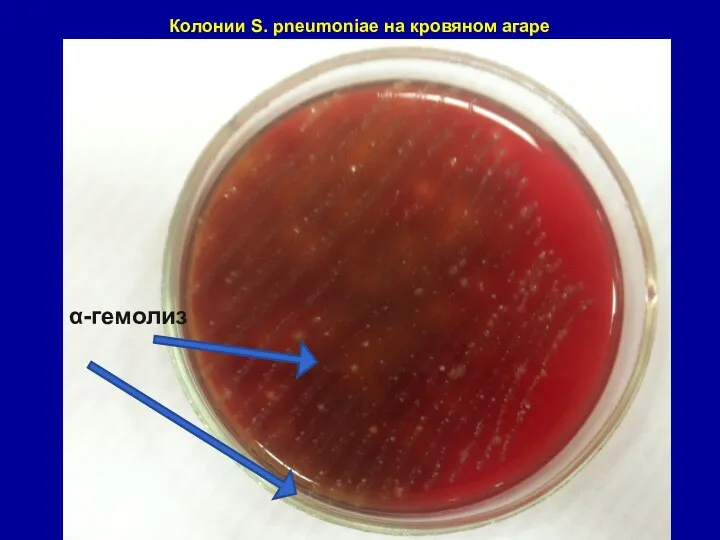 Колонии S. pneumoniae на кровяном агаре α-гемолиз