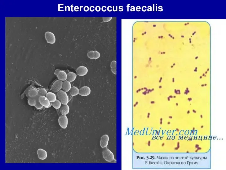 Enterococcus faecalis