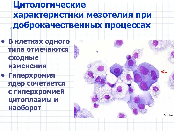 Цитологические характеристики мезотелия при доброкачественных процессах В клетках одного типа