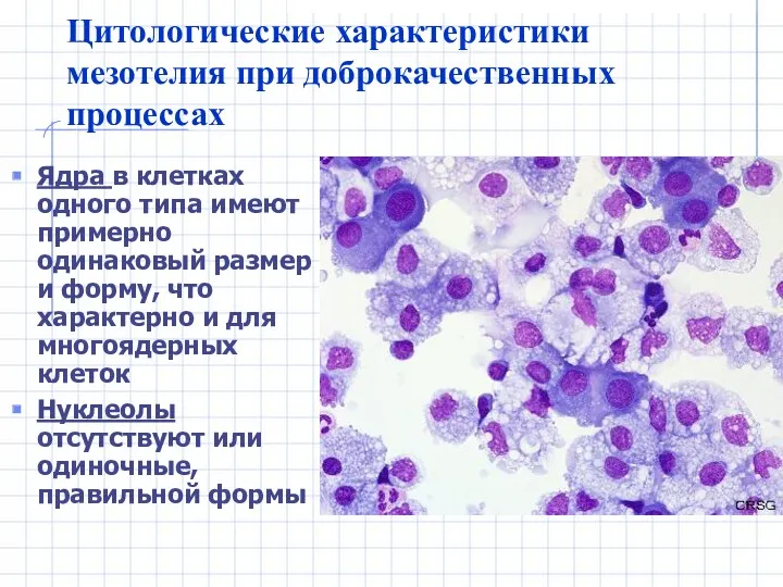 Цитологические характеристики мезотелия при доброкачественных процессах Ядра в клетках одного