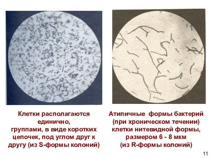 Клетки располагаются единично, группами, в виде коротких цепочек, под углом