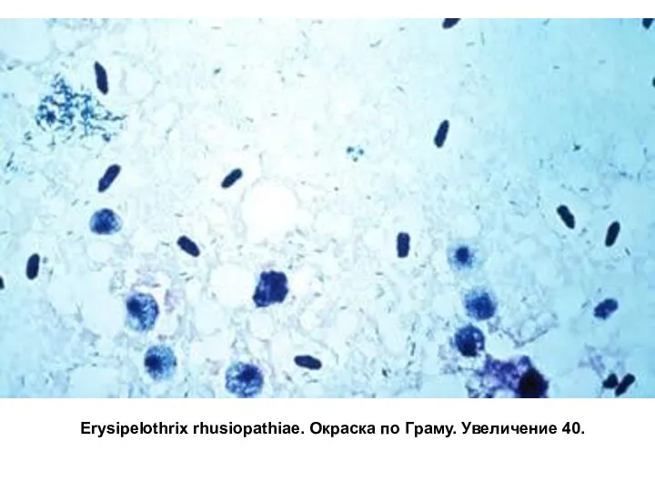 Erysipelothrix rhusiopathiae. Окраска по Граму. Увеличение 40.