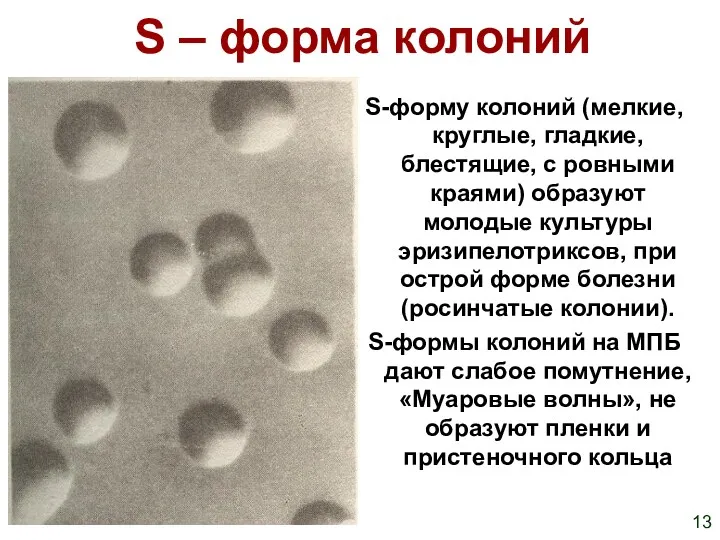 S – форма колоний S-форму колоний (мелкие, круглые, гладкие, блестящие,