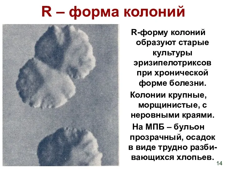 R – форма колоний R-форму колоний образуют старые культуры эризипелотриксов