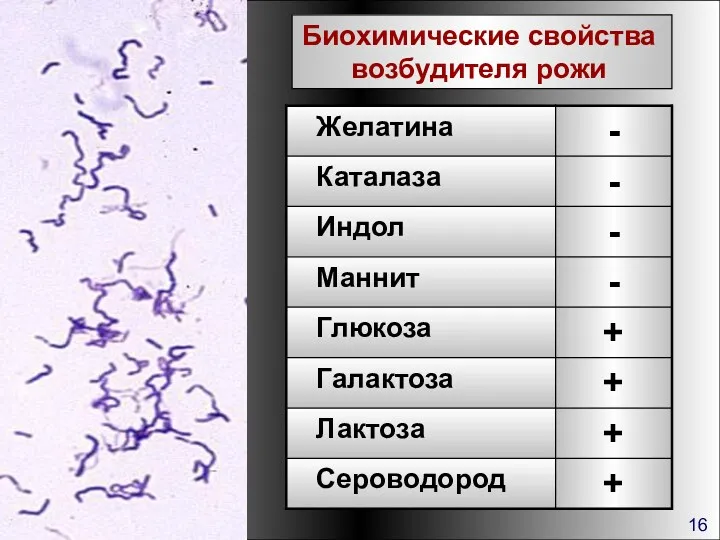 Биохимические свойства возбудителя рожи 16