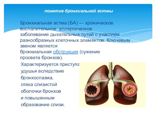 Бронхиальная астма (БА) — хроническое воспалительное аллергическое заболевание дыхательных путей