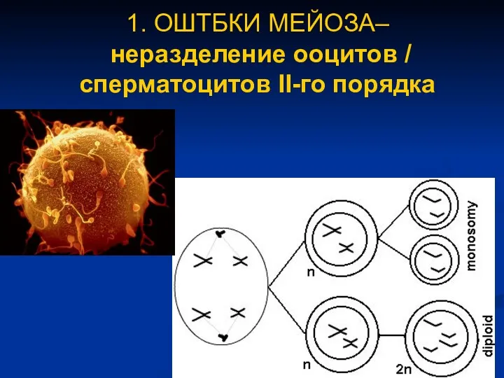 1. ОШТБКИ МЕЙОЗА– неразделение ооцитов / сперматоцитов II-го порядка