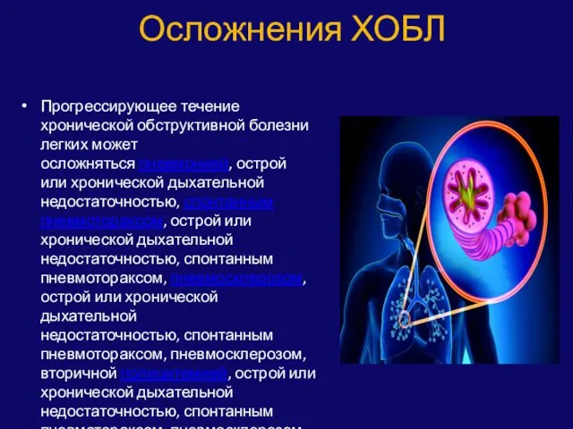 Осложнения ХОБЛ Прогрессирующее течение хронической обструктивной болезни легких может осложняться пневмонией, острой или