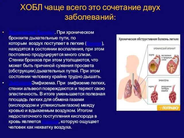 ХОБЛ чаще всего это сочетание двух заболеваний: Хронический бронхит. При хроническом бронхите дыхательные