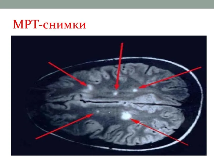 МРТ-снимки