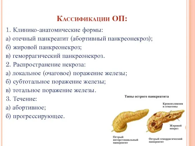 Кассификации ОП: 1. Клинико-анатомические формы: а) отечный панкреатит (абортивный панкреонекроз);