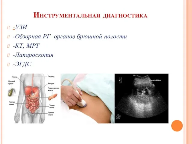 Инструментальная диагностика -УЗИ -Обзорная РГ органов брюшной полости -КТ, МРТ -Лапароскопия -ЭГДС