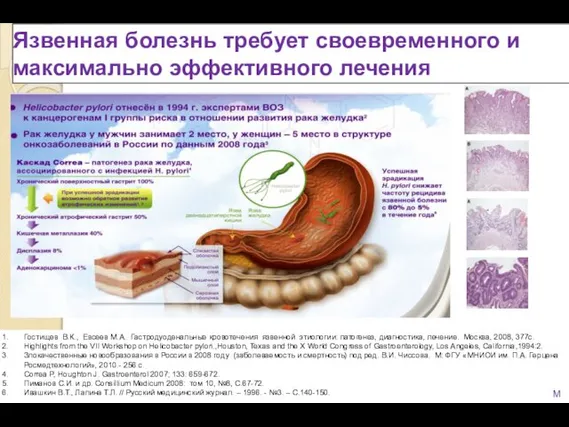 Язвенная болезнь требует своевременного и максимально эффективного лечения Гостищев В.К., Евсеев М.А. Гастродуоденальные