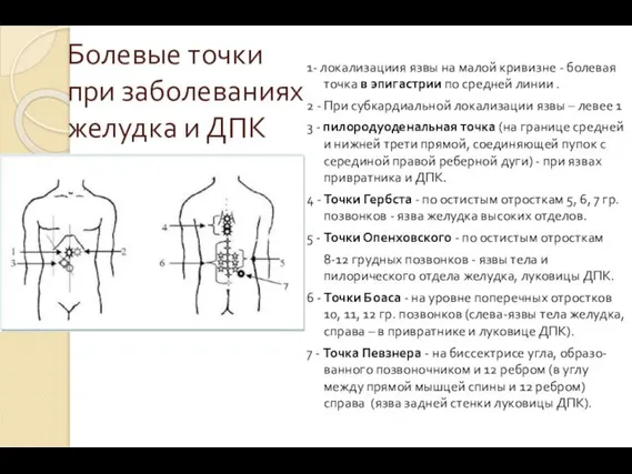 Болевые точки при заболеваниях желудка и ДПК 1- локализациия язвы