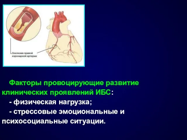 Факторы провоцирующие развитие клинических проявлений ИБС: - физическая нагрузка; - стрессовые эмоциональные и психосоциальные ситуации.