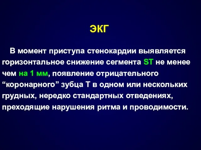 ЭКГ В момент приступа стенокардии выявляется горизонтальное снижение сегмента SТ