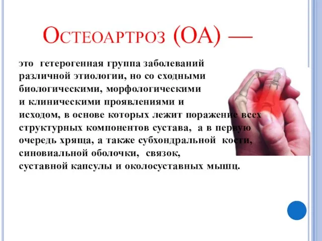 Остеоартроз (ОА) — это гетерогенная группа заболеваний различной этиологии, но