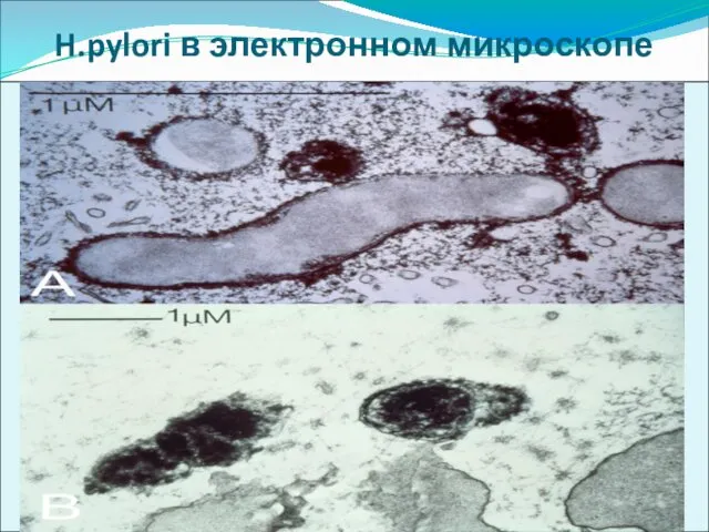 H.pylori в электронном микроскопе