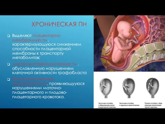 ХРОНИЧЕСКАЯ ПН Выделяют плацентарно- мембранную пн , характеризующуюся снижением способности