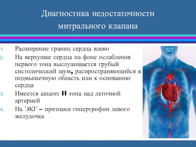 Диагностика недостаточности митрального клапана Расширение границ сердца влево На верхушке