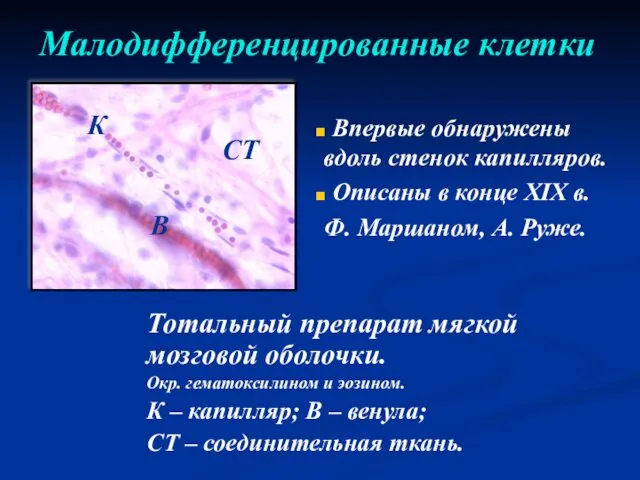 Малодифференцированные клетки Тотальный препарат мягкой мозговой оболочки. Окр. гематоксилином и