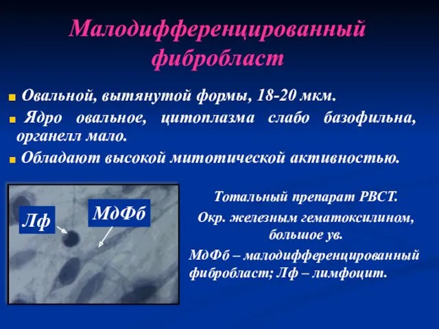 Малодифференцированный фибробласт Овальной, вытянутой формы, 18-20 мкм. Ядро овальное, цитоплазма