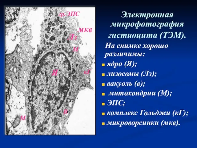 Электронная микрофотография гистиоцита (ТЭМ). На снимке хорошо различимы: ядро (Я);