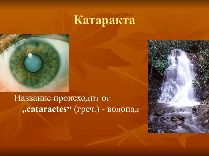 Катаракта Название происходит от „cataractes“ (греч.) - водопад