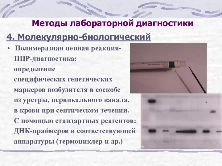 Методы лабораторной диагностики 4. Молекулярно-биологический Полимеразная цепная реакция- ПЦР-диагностика: определение