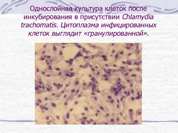 Однослойная культура клеток после инкубирования в присутствии Chlamydia trachomatis. Цитоплазма инфицированных клеток выглядит «гранулированной».