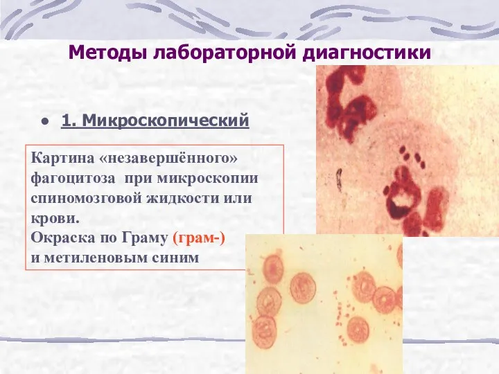 Методы лабораторной диагностики 1. Микроскопический Картина «незавершённого» фагоцитоза при микроскопии