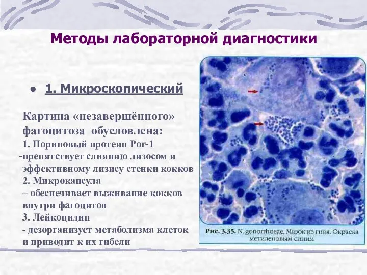 Методы лабораторной диагностики 1. Микроскопический Картина «незавершённого» фагоцитоза обусловлена: 1.