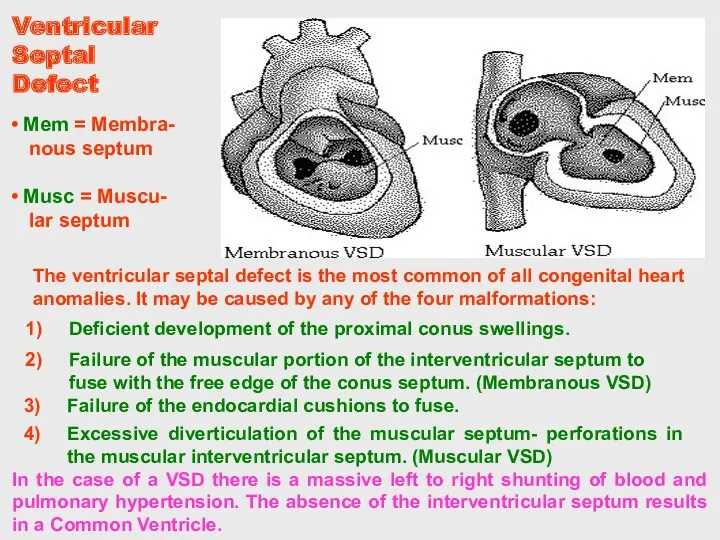 In the case of a VSD there is a massive