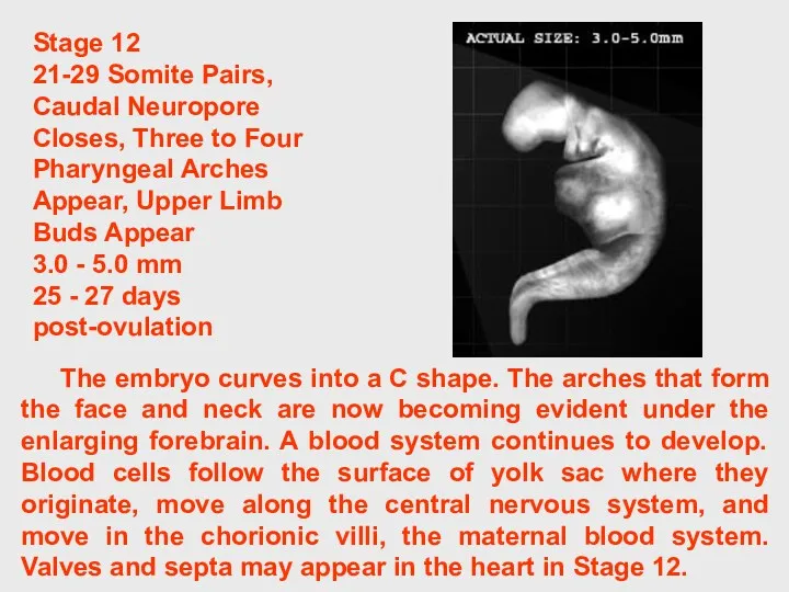 The embryo curves into a C shape. The arches that