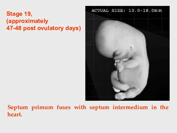 Septum primum fuses with septum intermedium in the heart. Stage 19, (approximately 47-48 post ovulatory days)