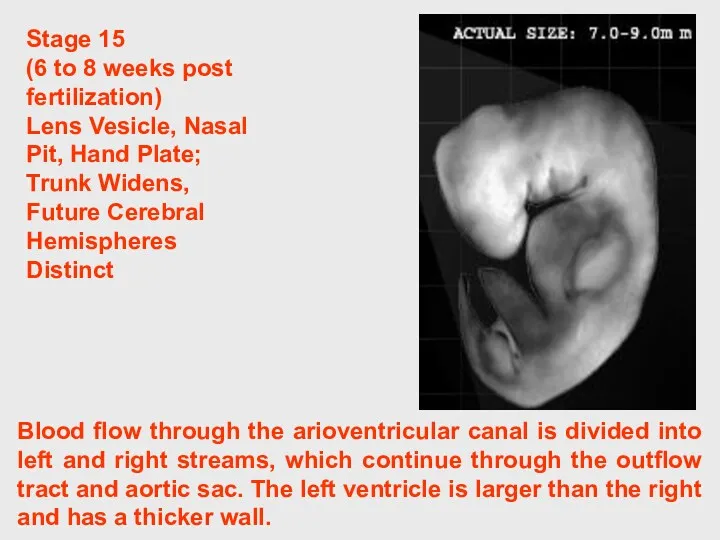 Blood flow through the arioventricular canal is divided into left