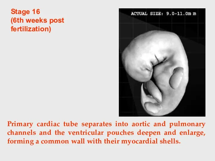 Stage 16 (6th weeks post fertilization) Primary cardiac tube separates