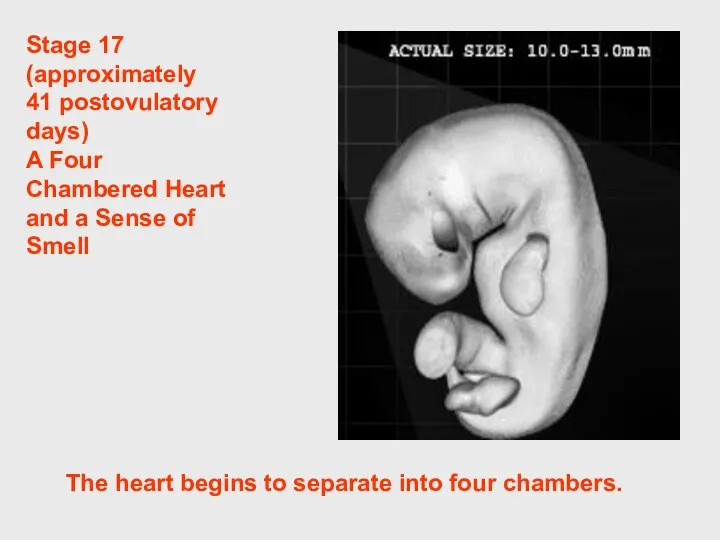 Stage 17 (approximately 41 postovulatory days) A Four Chambered Heart