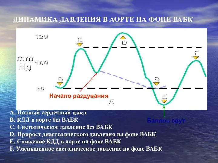 А. Полный сердечный цикл B. КДД в аорте без ВАБК