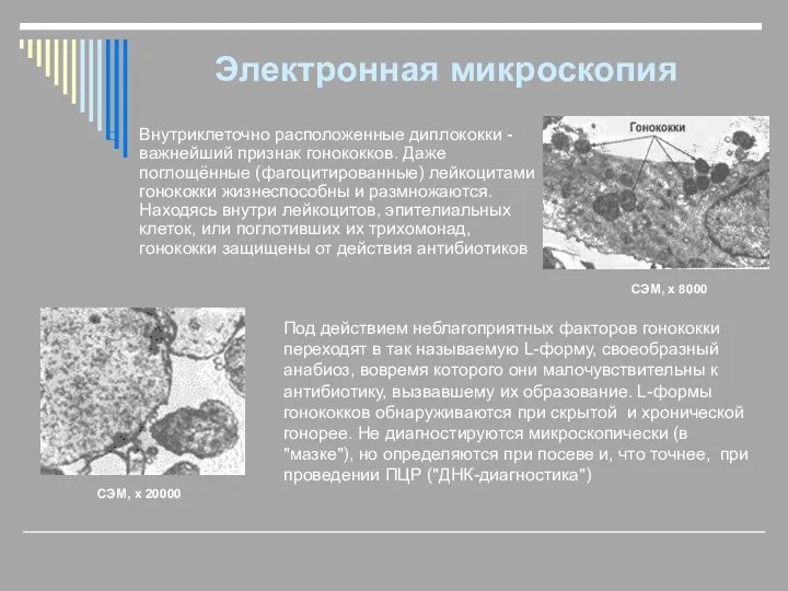 Электронная микроскопия Внутриклеточно расположенные диплококки - важнейший признак гонококков. Даже