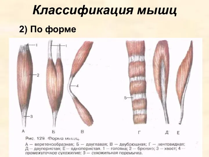 Классификация мышц 2) По форме