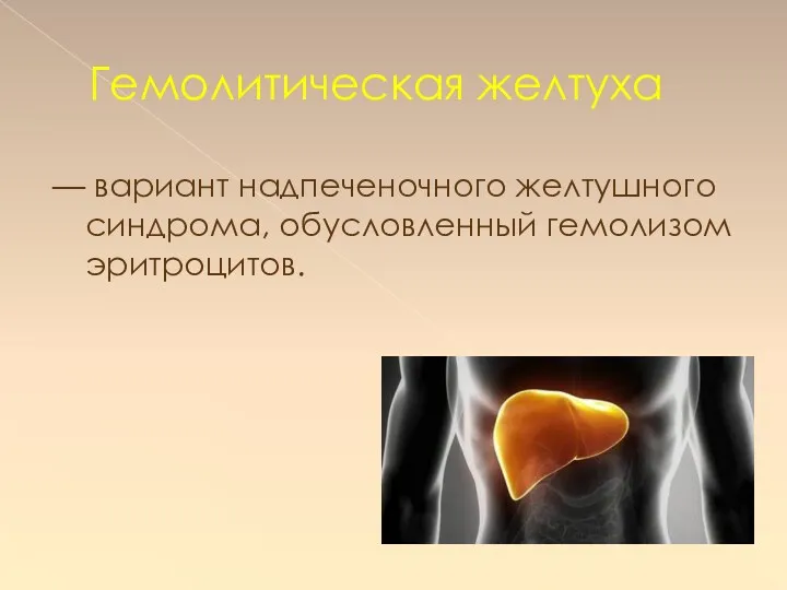 Гемолитическая желтуха — вариант надпеченочного желтушного синдрома, обусловленный гемолизом эритроцитов.