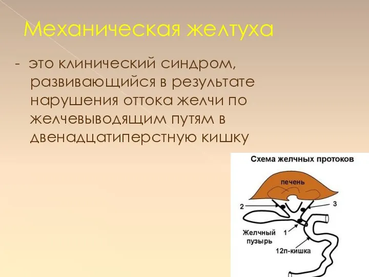 Механическая желтуха - это клинический синдром, развивающийся в результате нарушения